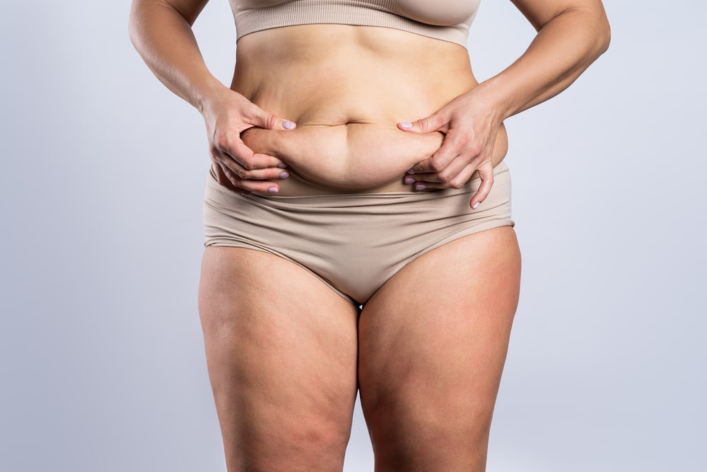 Achieve A Sculpted Waistline With Belt Lipectomy Surgery