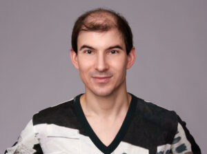 Revitalize Your Confidence Expert Hair Restoration At Beauty From Ashes Aesthetics